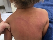 Mãe é presa por agredir filho de um ano em Maceió