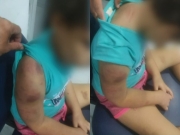 Mulher é detida por maus tratos e lesão corporal contra filha de seis anos em Paulista